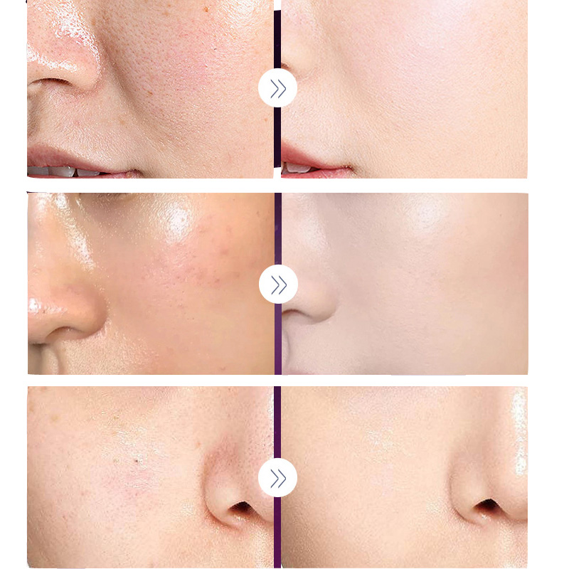 Luksusowy szlachetna dama krem – Luxury Skincare Whitening Cream recenzja i cena